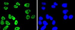 MSK1/RPS6KA5 Rabbit anti-Human, Rat, Clone: SN63-05, Novus Biologicals 100 &mu;L | Buy Online | Novus Biologicals | Fisher Scientific